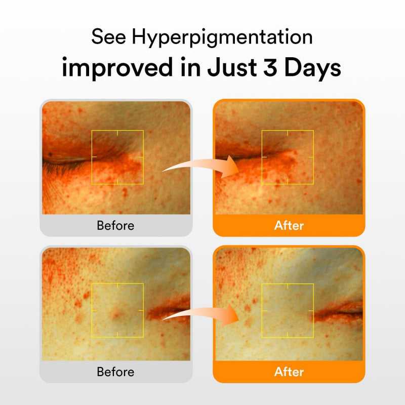 Abib Glutathiosome Dark Spot Glutathione Dark Spot Serum