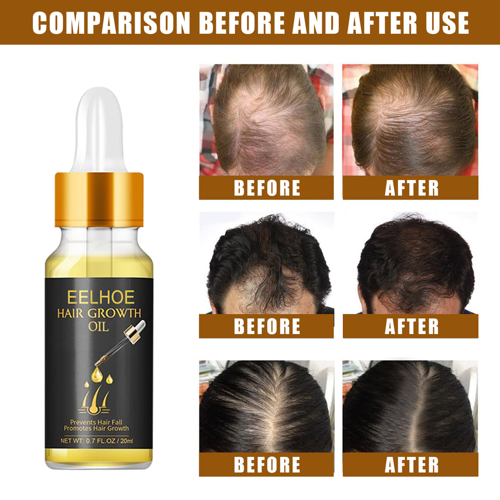 Premium  Hair Growth & Scalp Booster Serum