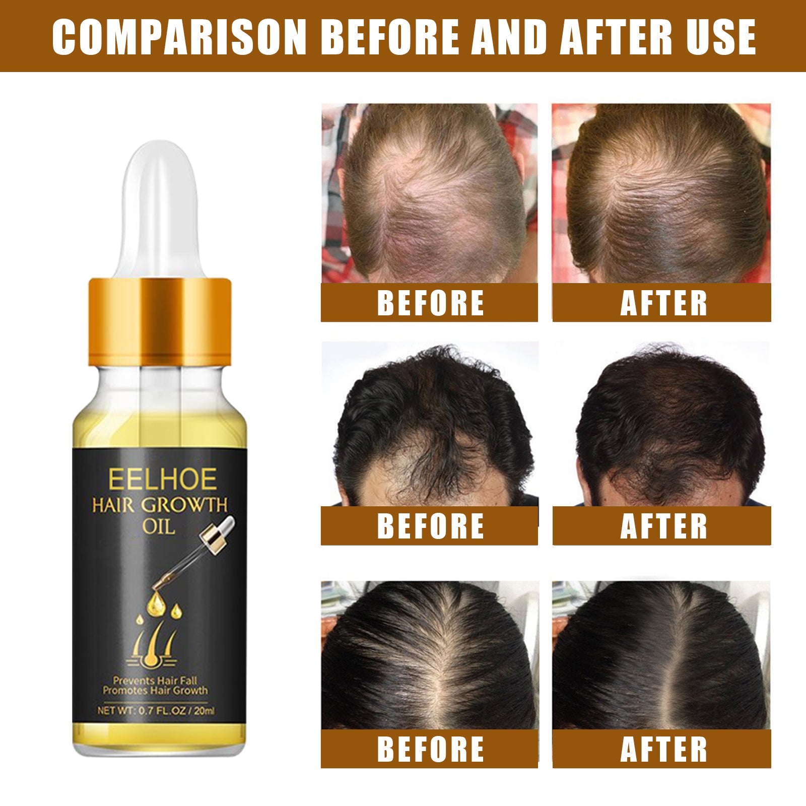 Premium  Hair Growth & Scalp Booster Serum